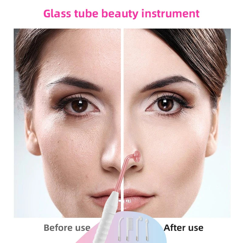 High Frequency Acne Therapy Facial Machine Electrotherapy