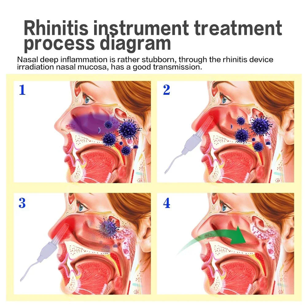 Therapeutic Laser Device for Sinus Allergy Relief and Nasal Congestion