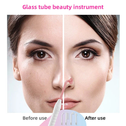 High Frequency Acne Therapy Facial Machine Electrotherapy