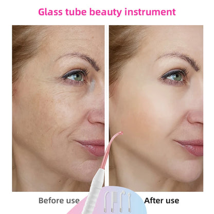 High Frequency Acne Therapy Facial Machine Electrotherapy