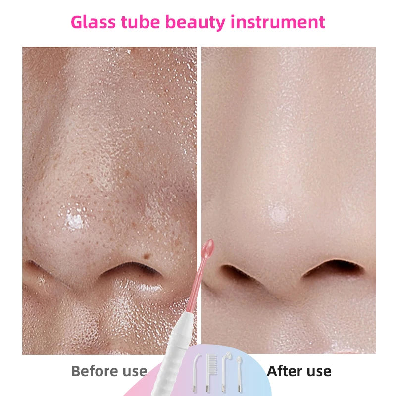 High Frequency Acne Therapy Facial Machine Electrotherapy